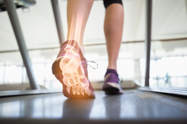 Imagem digital dos ossos do pé de uma pessoa caminhando em uma esteira.