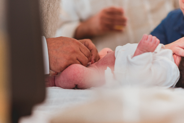Cerimônia judaica de circuncisão, correção da fimose, sendo realizada em um bebê.