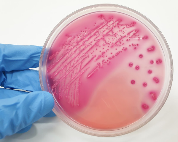 Mão segurando placa com colônias bacterianas.