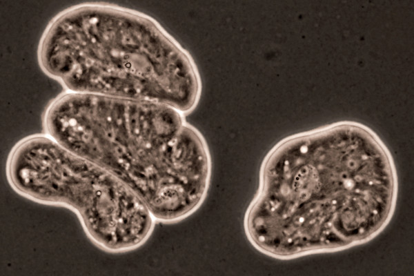 Protozoários vistos por meio de microscópio.