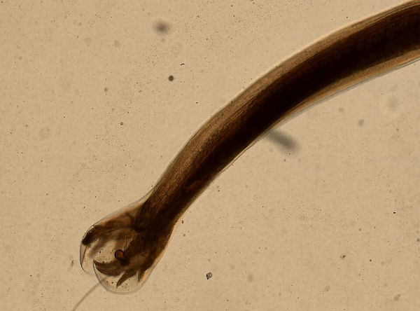 Imagem microscópica do Necator americanos, causador da verminose conhecida como amarelão ou ancilostomíase.