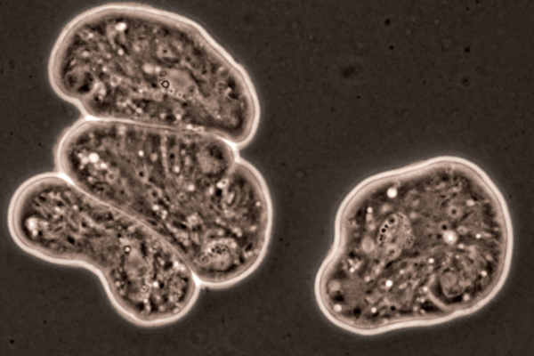 Entamoeba histolytica, uma ameba parasita que afeta o ser humano causando amebíase.