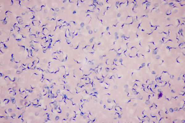 Imagem microscópica de um tecido sanguíneo com o protozoário Trypanossoma cruzi, tipo de ser vivo unicelular.