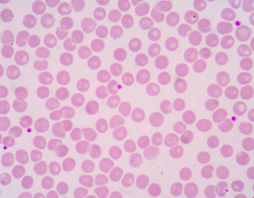 As hemácias são as células sanguíneas mais numerosas no sangue