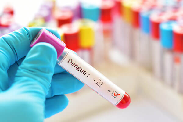 A dengue é uma doença que é diagnosticada por meio da análise dos sintomas e exames laboratoriais.