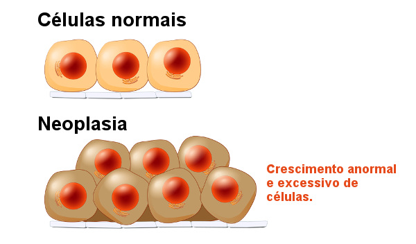 Abnormal Clits